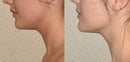 FaceSculpt® – Ritual de Drenagem Facial Premium