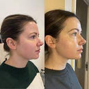 FaceSculpt® – Ritual de Drenagem Facial Premium