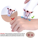 PureSkin™ – Removedor de Cravos Profissional por Sucção Inteligente